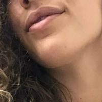 plscrycarmen Nahé