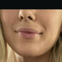 Wettmelons Nahé